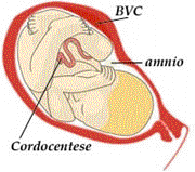 amniocentse biopsie de villosits choriales et de trophoblaste