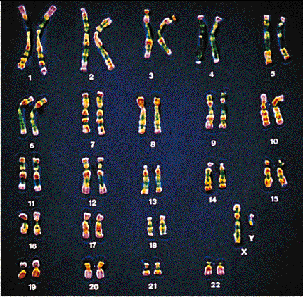 Caryotype d'un tre humain de sexe masculin